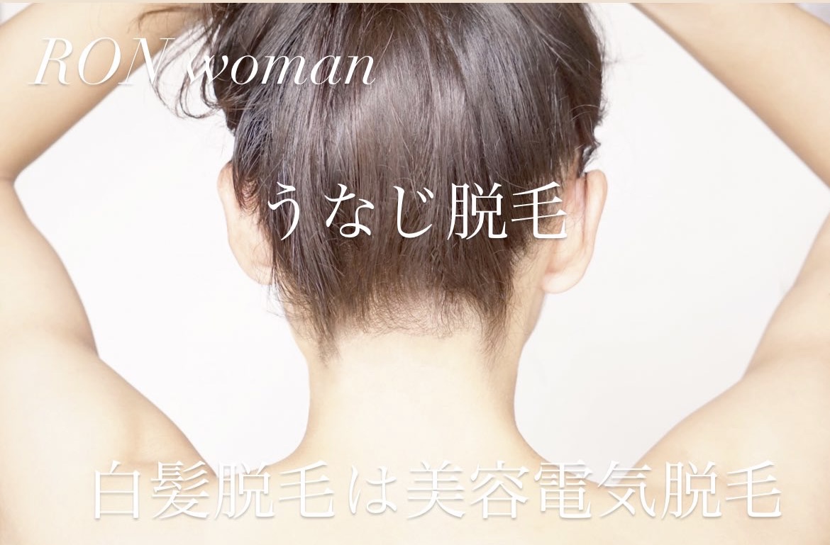 画像の説明
