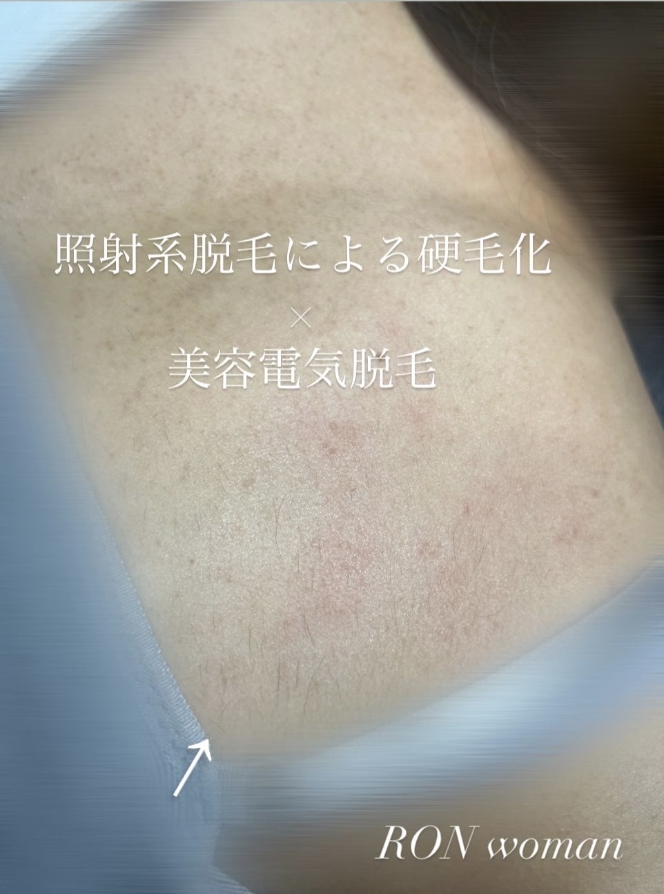 画像の説明