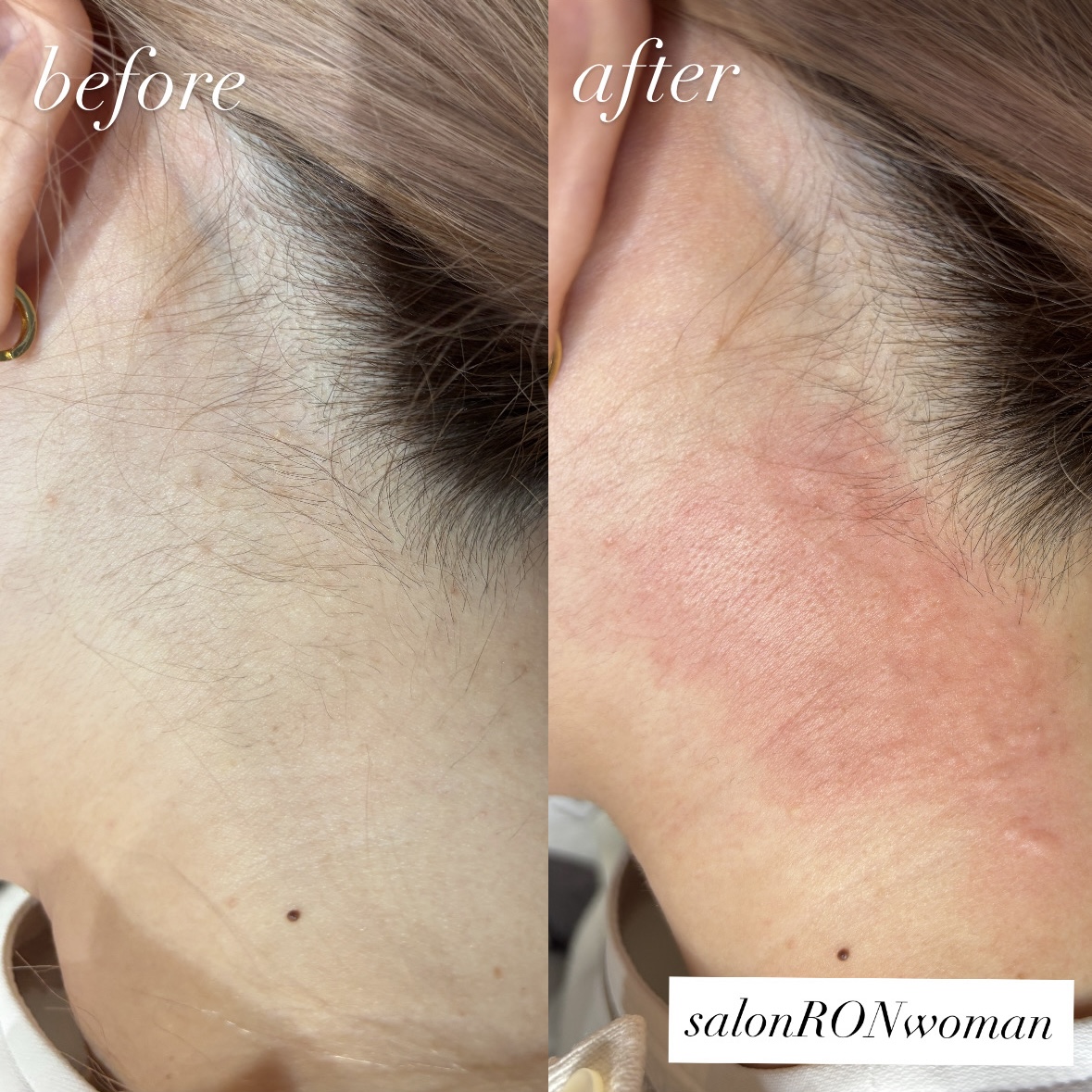 画像の説明 画像の説明