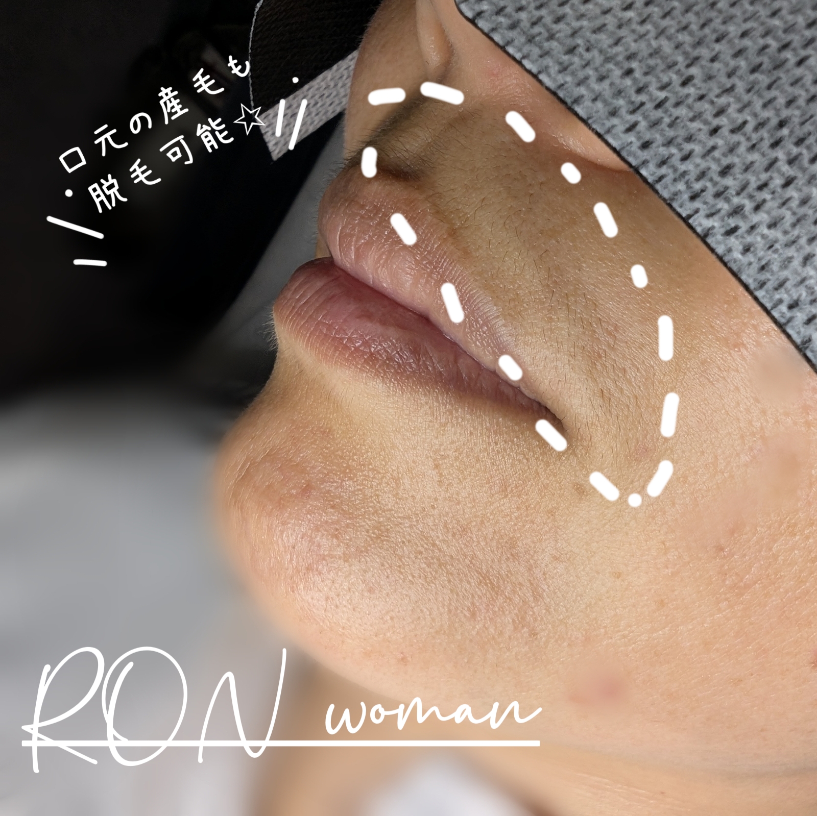 画像の説明 画像の説明