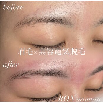 画像の説明 画像の説明