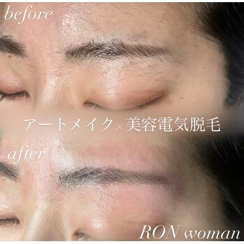 画像の説明 画像の説明