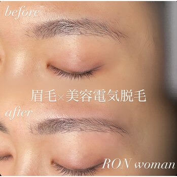 画像の説明 画像の説明