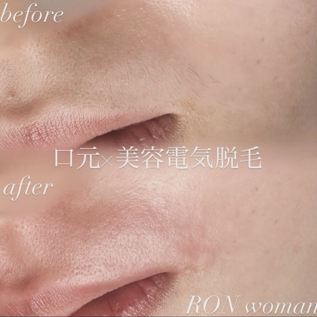 画像の説明