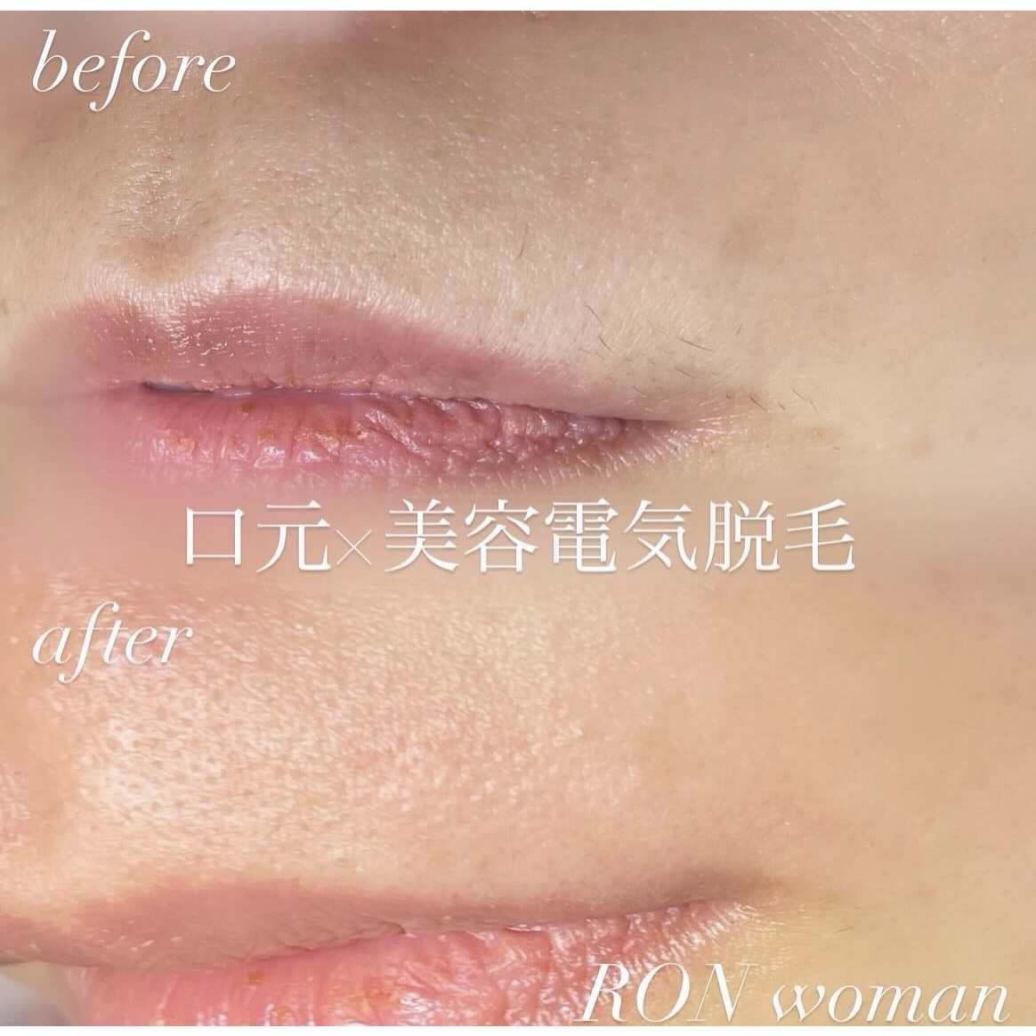 画像の説明 画像の説明