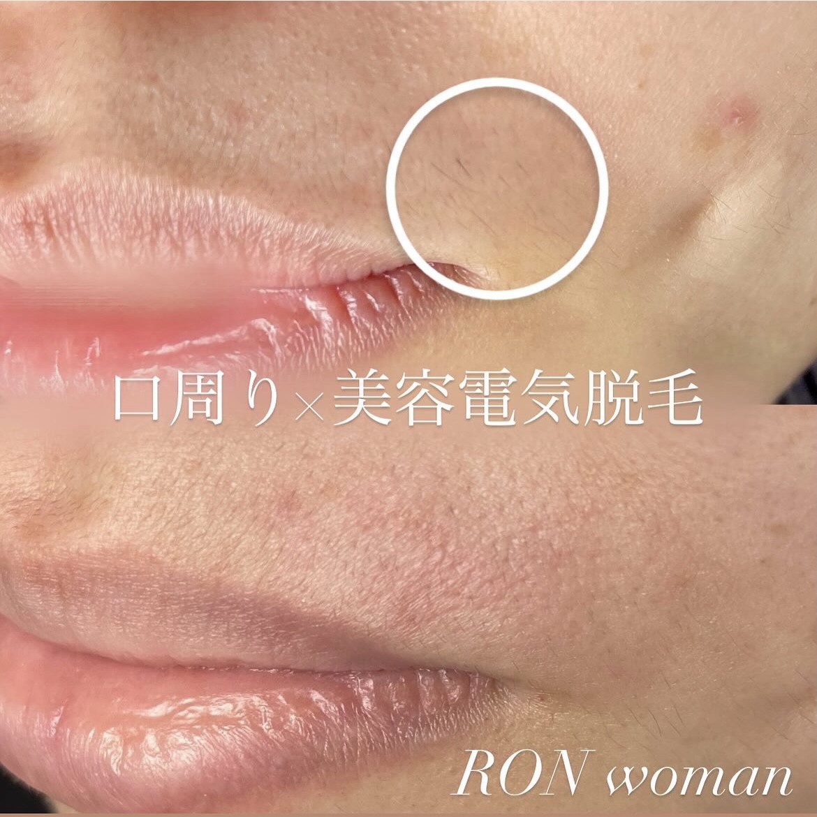 画像の説明 画像の説明