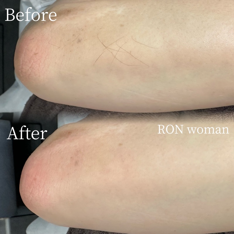 画像の説明 画像の説明