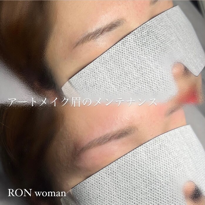 画像の説明