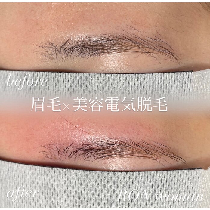 画像の説明 画像の説明