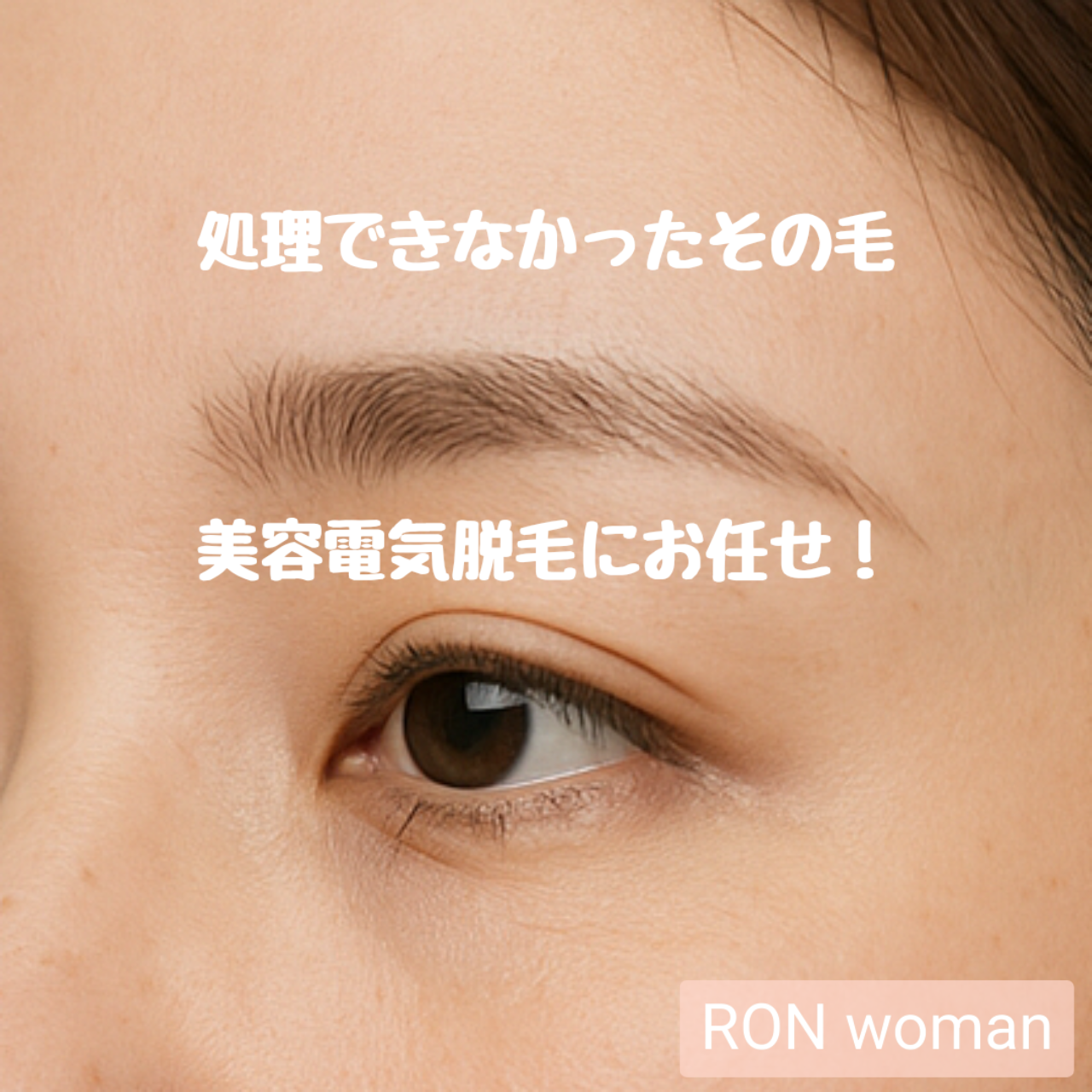 画像の説明