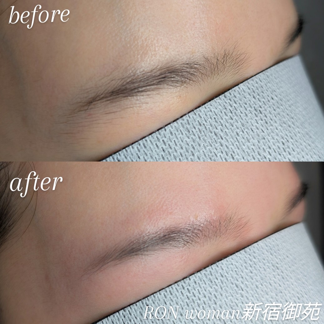 画像の説明 画像の説明