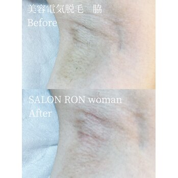 I119177617 (1) I119177617 (1)