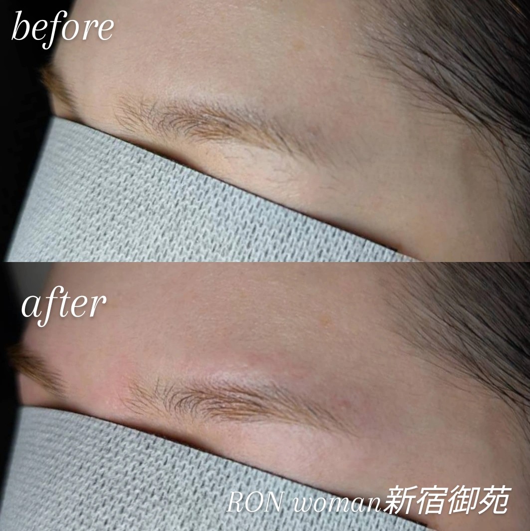 IMG_20251130_115912_680~2 IMG_20251130_115912_680~2