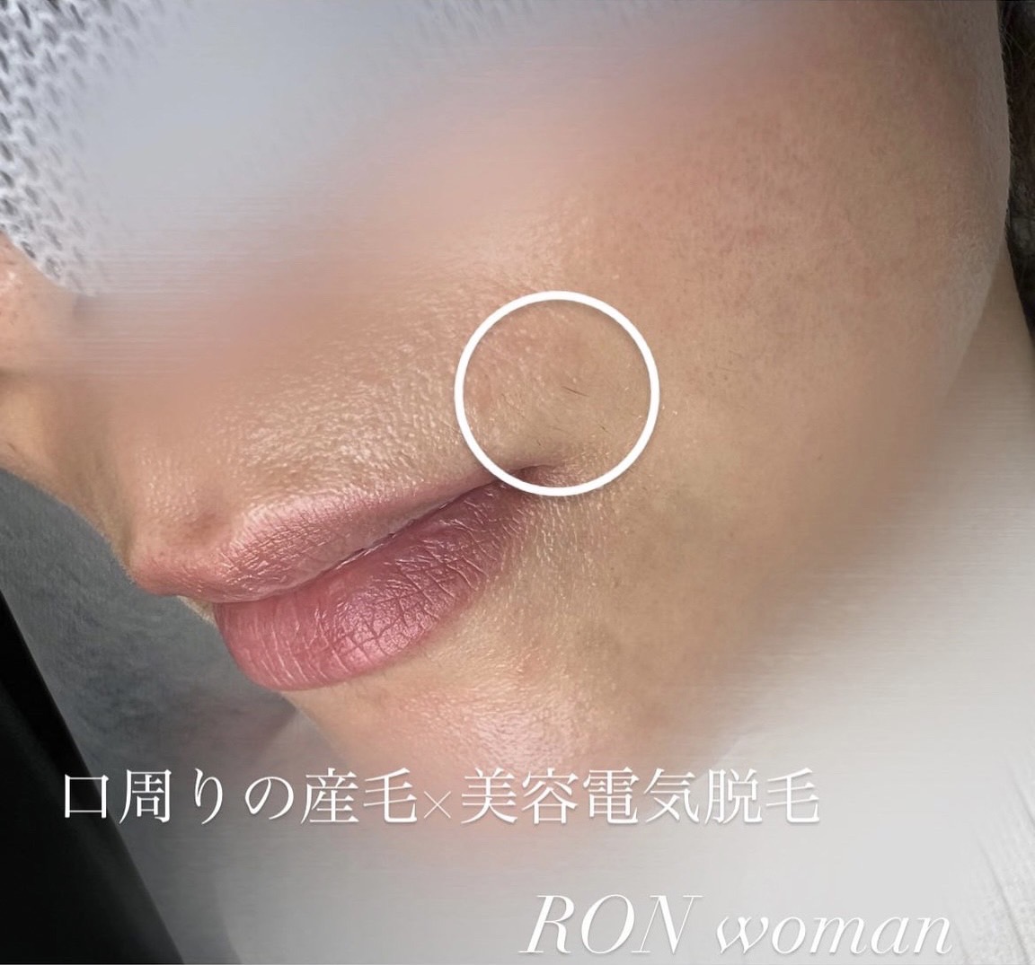 画像の説明