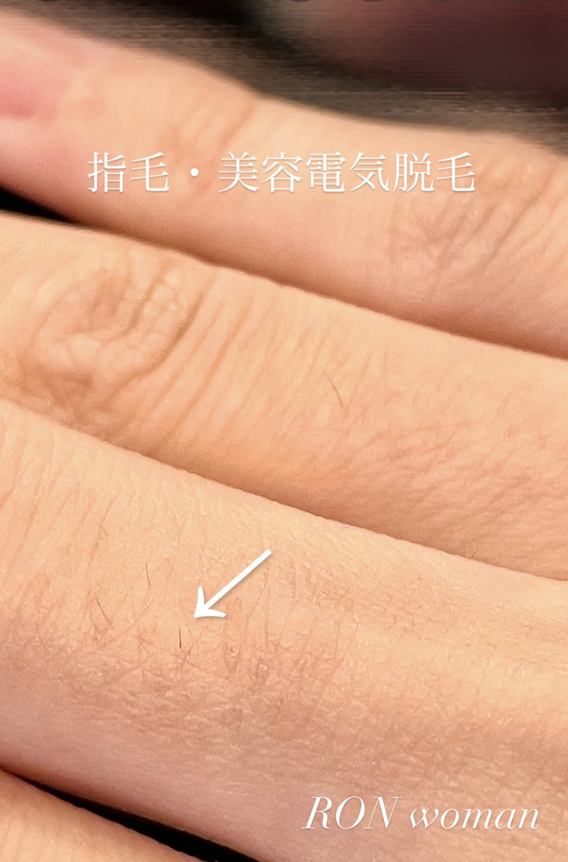 画像の説明