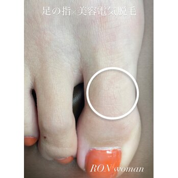 画像の説明