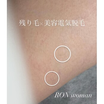 画像の説明